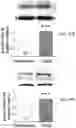 Fig. 36 - APKC inhibitors and methods of treating a neurodegenerative disease or disorder