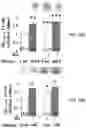 Fig. 37 - APKC inhibitors and methods of treating a neurodegenerative disease or disorder