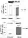 Fig. 39 - APKC inhibitors and methods of treating a neurodegenerative disease or disorder