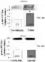 Fig. 40 - APKC inhibitors and methods of treating a neurodegenerative disease or disorder