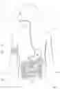 Fig. 03 - COMPOSITION AND ASSOCIATED DELIVERY DEVICE FOR HYDROGEN THERAPY