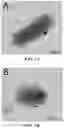 Fig. 04 - Biosynthesis of Selenium Nanoparticles Having Antimicrobial Activity