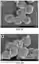 Fig. 12 - Biosynthesis of Selenium Nanoparticles Having Antimicrobial Activity