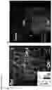 Fig. 03 - Methods of treating optic nerve diseases using neural progenitor cell growth factors