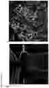 Fig. 04 - Methods of treating optic nerve diseases using neural progenitor cell growth factors