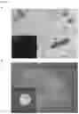 Fig. 08 - Methods of treating optic nerve diseases using neural progenitor cell growth factors