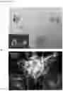 Fig. 09 - Methods of treating optic nerve diseases using neural progenitor cell growth factors