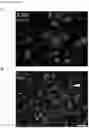 Fig. 11 - Methods of treating optic nerve diseases using neural progenitor cell growth factors