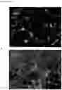 Fig. 12 - Methods of treating optic nerve diseases using neural progenitor cell growth factors