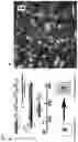 Fig. 15 - Methods of treating optic nerve diseases using neural progenitor cell growth factors