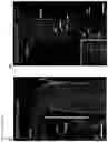 Fig. 16 - Methods of treating optic nerve diseases using neural progenitor cell growth factors