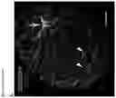 Fig. 18 - Methods of treating optic nerve diseases using neural progenitor cell growth factors