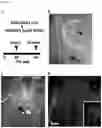 Fig. 19 - Methods of treating optic nerve diseases using neural progenitor cell growth factors