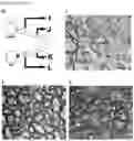 Fig. 21 - Methods of treating optic nerve diseases using neural progenitor cell growth factors