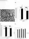 Fig. 22 - Methods of treating optic nerve diseases using neural progenitor cell growth factors