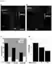 Fig. 23 - Methods of treating optic nerve diseases using neural progenitor cell growth factors