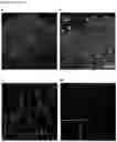 Fig. 24 - Methods of treating optic nerve diseases using neural progenitor cell growth factors