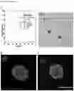 Fig. 25 - Methods of treating optic nerve diseases using neural progenitor cell growth factors