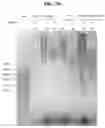 Fig. 04 - COMPOSITIONS AND METHODS FOR PREVENTING THE PROLIFERATION AND EPITHELIAL-MESENCHYMAL TRANSITION OF EPITHELIAL CELLS