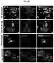 Fig. 08 - COMPOSITIONS AND METHODS FOR PREVENTING THE PROLIFERATION AND EPITHELIAL-MESENCHYMAL TRANSITION OF EPITHELIAL CELLS