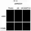 Fig. 11 - COMPOSITIONS AND METHODS FOR PREVENTING THE PROLIFERATION AND EPITHELIAL-MESENCHYMAL TRANSITION OF EPITHELIAL CELLS