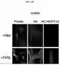 Fig. 12 - COMPOSITIONS AND METHODS FOR PREVENTING THE PROLIFERATION AND EPITHELIAL-MESENCHYMAL TRANSITION OF EPITHELIAL CELLS