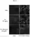 Fig. 16 - COMPOSITIONS AND METHODS FOR PREVENTING THE PROLIFERATION AND EPITHELIAL-MESENCHYMAL TRANSITION OF EPITHELIAL CELLS
