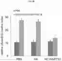 Fig. 17 - COMPOSITIONS AND METHODS FOR PREVENTING THE PROLIFERATION AND EPITHELIAL-MESENCHYMAL TRANSITION OF EPITHELIAL CELLS