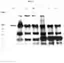 Fig. 24 - COMPOSITIONS AND METHODS FOR PREVENTING THE PROLIFERATION AND EPITHELIAL-MESENCHYMAL TRANSITION OF EPITHELIAL CELLS