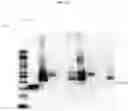 Fig. 25 - COMPOSITIONS AND METHODS FOR PREVENTING THE PROLIFERATION AND EPITHELIAL-MESENCHYMAL TRANSITION OF EPITHELIAL CELLS