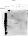 Fig. 26 - COMPOSITIONS AND METHODS FOR PREVENTING THE PROLIFERATION AND EPITHELIAL-MESENCHYMAL TRANSITION OF EPITHELIAL CELLS