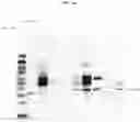 Fig. 27 - COMPOSITIONS AND METHODS FOR PREVENTING THE PROLIFERATION AND EPITHELIAL-MESENCHYMAL TRANSITION OF EPITHELIAL CELLS