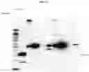 Fig. 28 - COMPOSITIONS AND METHODS FOR PREVENTING THE PROLIFERATION AND EPITHELIAL-MESENCHYMAL TRANSITION OF EPITHELIAL CELLS