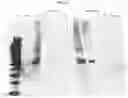 Fig. 29 - COMPOSITIONS AND METHODS FOR PREVENTING THE PROLIFERATION AND EPITHELIAL-MESENCHYMAL TRANSITION OF EPITHELIAL CELLS
