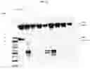 Fig. 30 - COMPOSITIONS AND METHODS FOR PREVENTING THE PROLIFERATION AND EPITHELIAL-MESENCHYMAL TRANSITION OF EPITHELIAL CELLS
