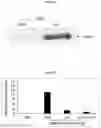 Fig. 31 - COMPOSITIONS AND METHODS FOR PREVENTING THE PROLIFERATION AND EPITHELIAL-MESENCHYMAL TRANSITION OF EPITHELIAL CELLS