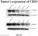 Fig. 21 - COMPOSITIONS AND METHODS FOR CANCER THERAPY