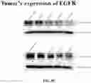 Fig. 22 - COMPOSITIONS AND METHODS FOR CANCER THERAPY