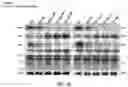 Fig. 65 - COMPOSITIONS AND METHODS FOR CANCER THERAPY