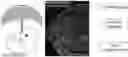 Fig. 01 - COMPOSITIONS, METHODS FOR REGULATING UTERINE, PLACENTAL GROWTH