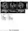 Fig. 13 - COMPOSITIONS, METHODS FOR REGULATING UTERINE, PLACENTAL GROWTH