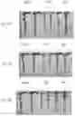 Fig. 11 - strain and use thereof