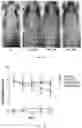 Fig. 17 - strain and use thereof