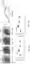 Fig. 11 - Lactobacillus Gasseri KBL697 strain and use thereof