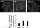 Fig. 01 - CO-ADMINISTRATION COMPOSITION FOR PREVENTING OR TREATING HYPERCHOLESTEROLEMIA, CONTAINING BALLOON-FLOWER EXTRACT OR PLATYCODIN D DERIVED THEREFROM AS ACTIVE INGREDIENT