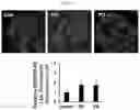 Fig. 04 - CO-ADMINISTRATION COMPOSITION FOR PREVENTING OR TREATING HYPERCHOLESTEROLEMIA, CONTAINING BALLOON-FLOWER EXTRACT OR PLATYCODIN D DERIVED THEREFROM AS ACTIVE INGREDIENT
