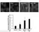 Fig. 09 - CO-ADMINISTRATION COMPOSITION FOR PREVENTING OR TREATING HYPERCHOLESTEROLEMIA, CONTAINING BALLOON-FLOWER EXTRACT OR PLATYCODIN D DERIVED THEREFROM AS ACTIVE INGREDIENT