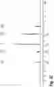 Fig. 06 - POLYMERIC NANOPARTICLES AND A PROCESS OF PREPARATION THEREOF