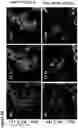 Fig. 10 - METHODS AND COMPOSITIONS COMPRISING A C-TERMINAL BAX PEPTIDE