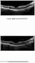 Fig. 09 - METHOD OF TREATING CONDITIONS OF THE EYE WITH AN ANTI-VEGF DARPIN